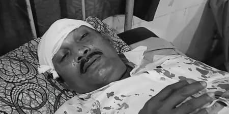 टीएमसी के बदमाशों ने मेरे सिर पर रॉड से वार किया : भाजपा पोलिंग एजेंट