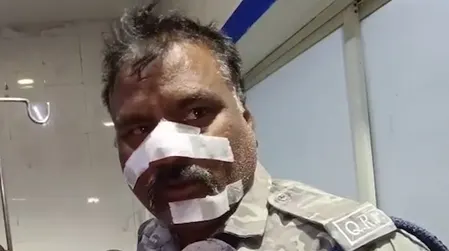 मध्य प्रदेश : भारत की जीत का जश्न मना रहे लोगों के पटाखे फोड़ने से पुलिसकर्मी घायल