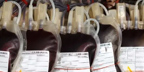 सतना में बच्चों को संक्रमित रक्त चढ़ाने के मामले में ब्लड बैंक प्रभारी सहित तीन सस्पेंड