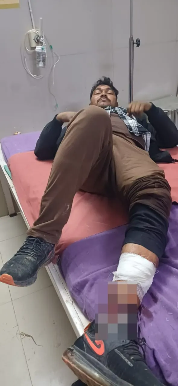 पुलिस मुठभेड़ में एक गौतस्कर घायल,एक फरार