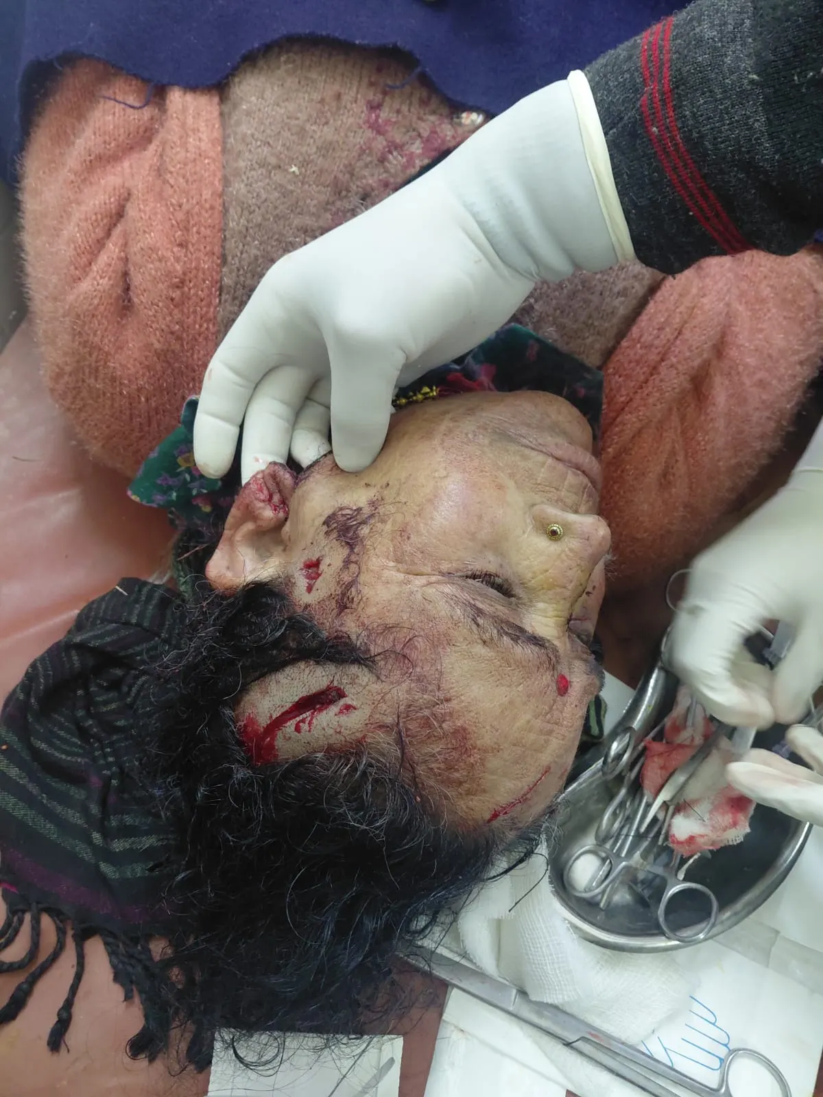 बड़कोट भालू के हमले में महिला घायल , ग्रामीणों में दहशत