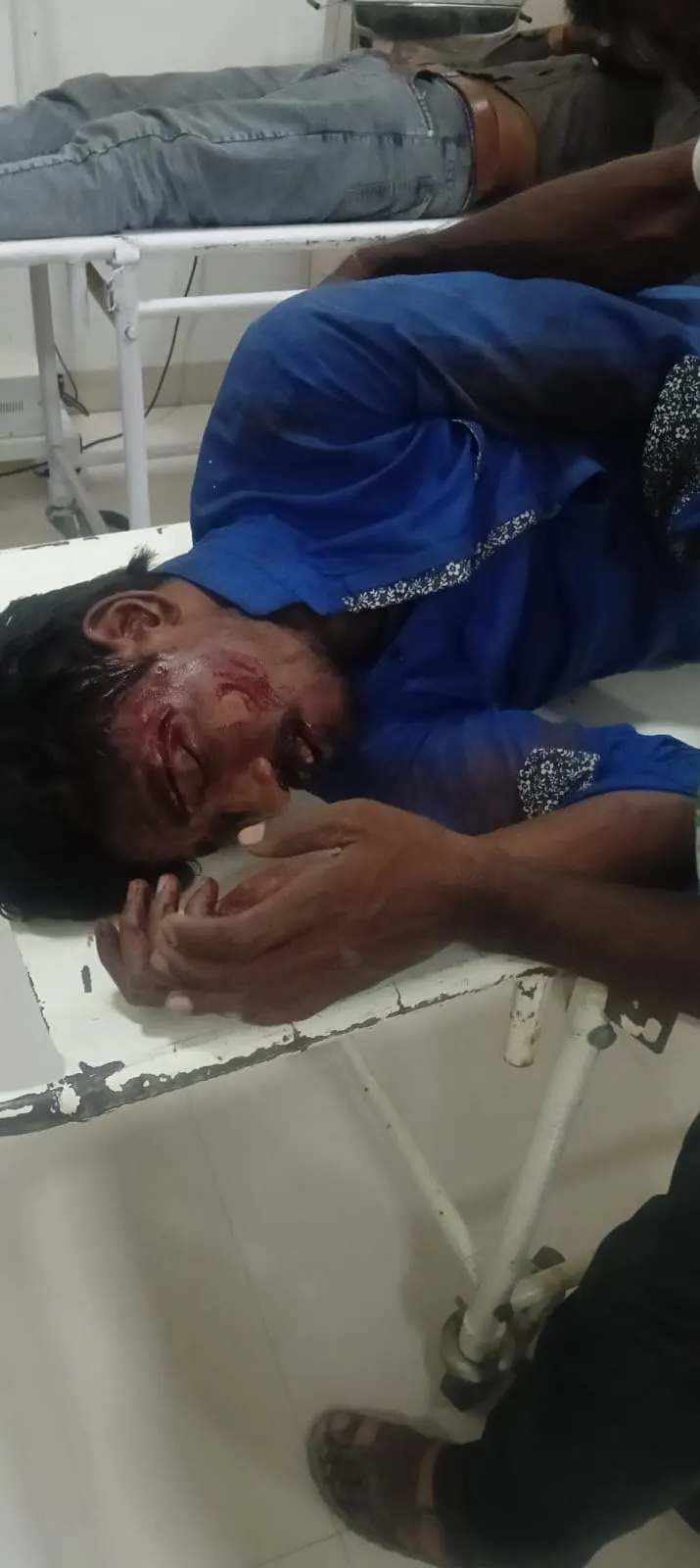 राजगढ़ः खड़ी ट्रॉली से टकराई बाइक, एक युवक की मौत, दो घायल