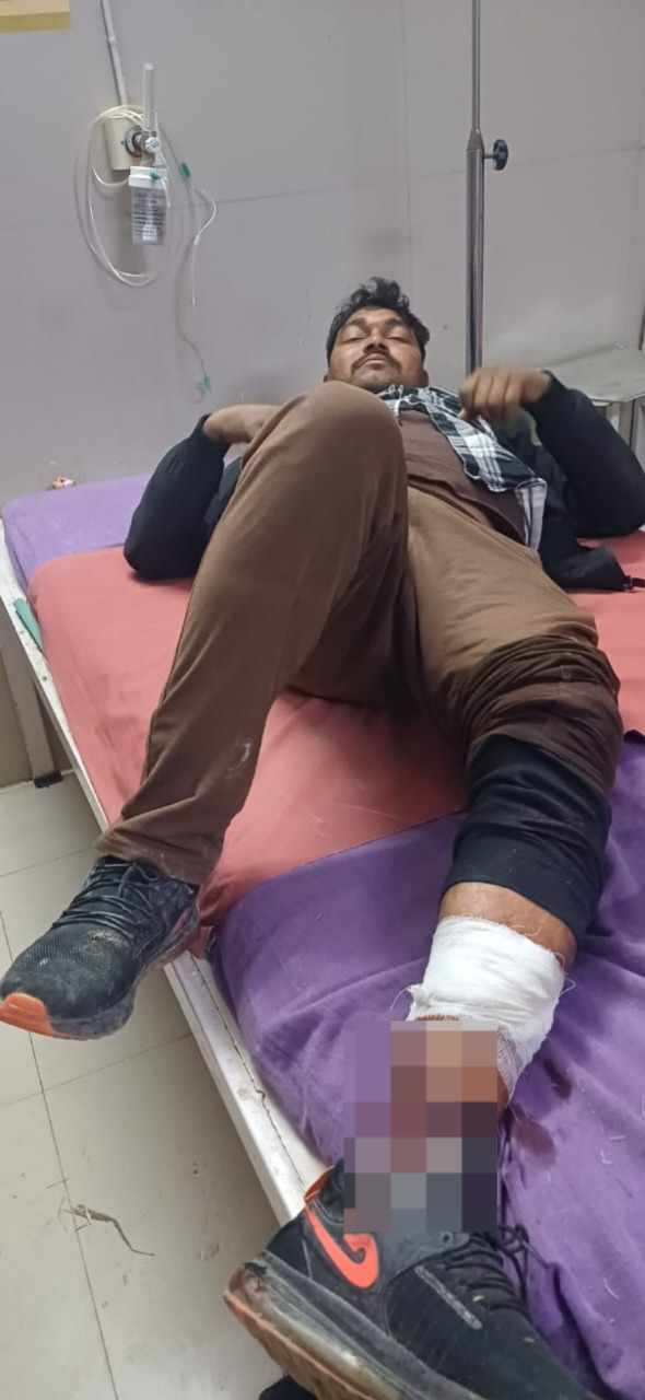 पुलिस मुठभेड़ में एक गौतस्कर घायल,एक फरार