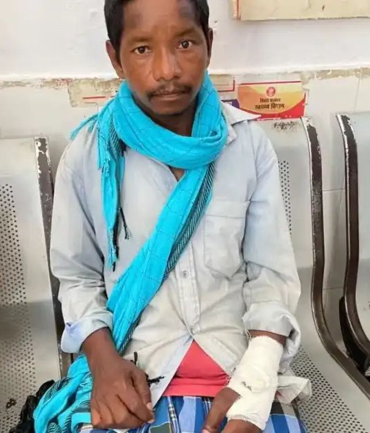 भालू के हमले से हरनाटांड़ में दहशत, ग्रामीण गंभीर रूप से घायल