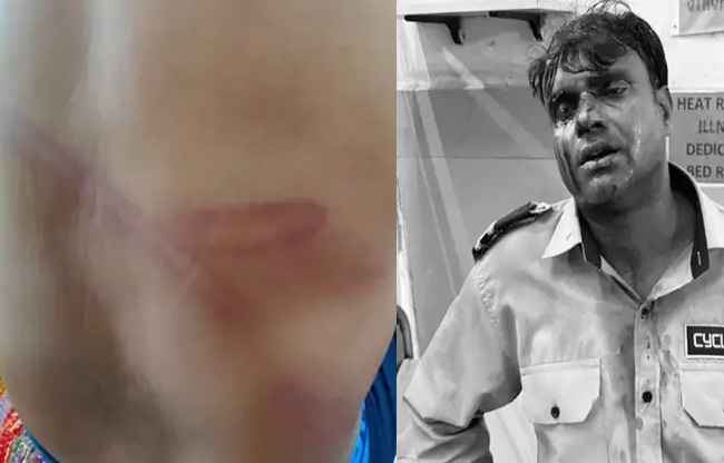 सोनीपत: निफ्टेम कॉलेज के सुरक्षा गार्ड पर जानलेवा हमला, छह आरोपियों पर केस दर्ज