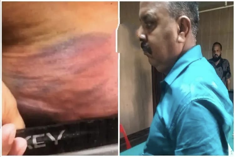 पलामू में DSP पर बेरहमी से पिटाई का आरोप, मेडिकल रिपोर्ट में गंभीर चोट लगने की पुष्टि