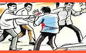 इंदौर की चोइथराम मंडी में देर रात चाकूबाजी, शराब के लिए रुपए नहीं देने पर हमला, चार कर्मचारी घायल